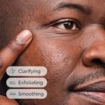 The Ordinary Salicylic Acid 2% Solution, Acne-Fighting Serum For Blemish-Prone Skin - Image 3