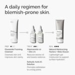 The Ordinary Salicylic Acid 2% Solution, Acne-Fighting Serum For Blemish-Prone Skin - Image 2